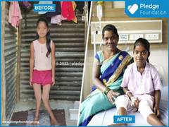 
      
      Pledge Foundation saved life of 12-year-old Rupali
      
      