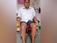 
      
      Saishree Hospital first in Maharashtra to successfully...
      
      