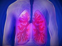 
      
      People with HIV at higher risk of COPD
      
      