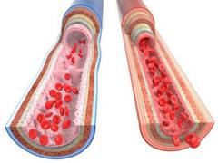 
      
      Study finds ageing stiffens blood vessels in women
      
      