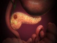 
      
      Many pancreatic cancer patients don't receive treatment that...
      
      