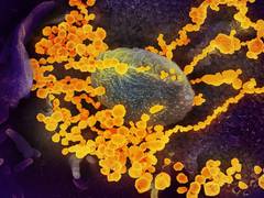 
      
      Netherlands confirms first case of coronavirus
      
      