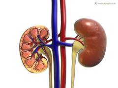 
      
      Here's why many kidney transplants fail
      
      