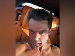
      
      Bobby Deol marks three years of 'Race 3', says eager to show...
      
      