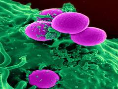 
      
      Tumours change their metabolism to spread more effectively: Study
      
      