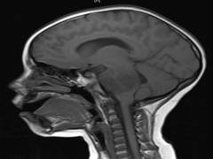 
      
      Study: Imaging appearance of ballistic wounds predicts bullet...
      
      