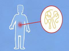
      
      Study finds new way to halt excessive inflammation in body
      
      