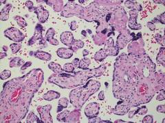 
      
      Researchers identify process vital to placenta growth in...
      
      