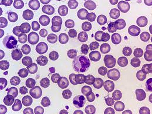 Representative image