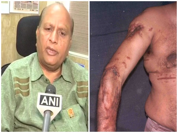 A victim of 1993 Bombay Blast case, Kirti Ajmera, demands compensation on Friday. Photo/ANI