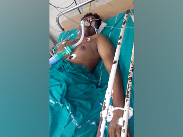 The kin of Kiran Kumar have alleged that the police beat him up badly for not wearing a mask. (Photo/ANI)