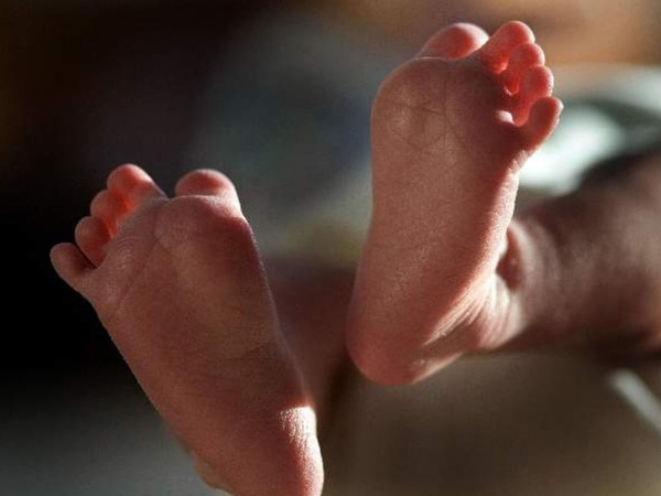 Representative Image.