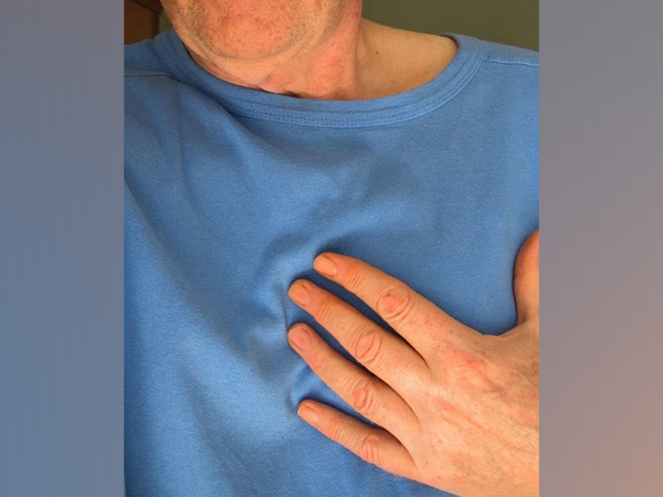 Representative image