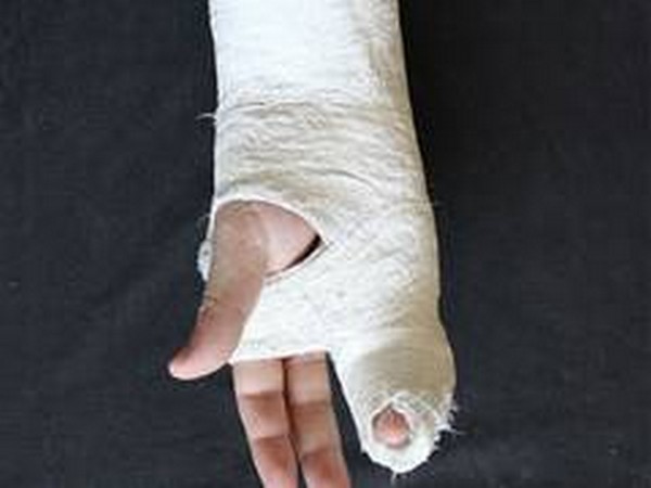 Representative image