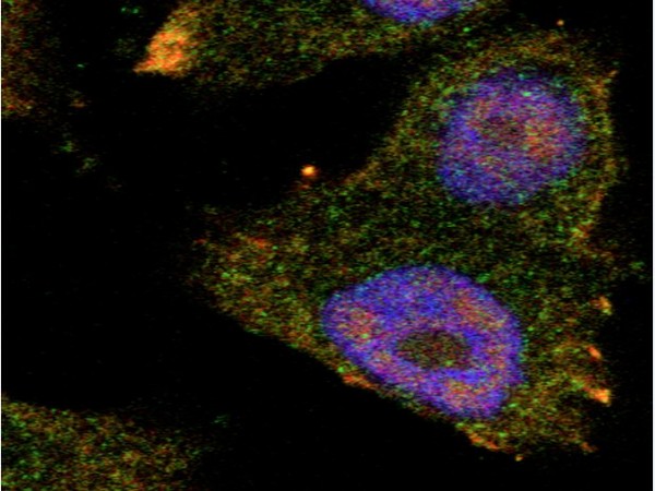 Representative Image