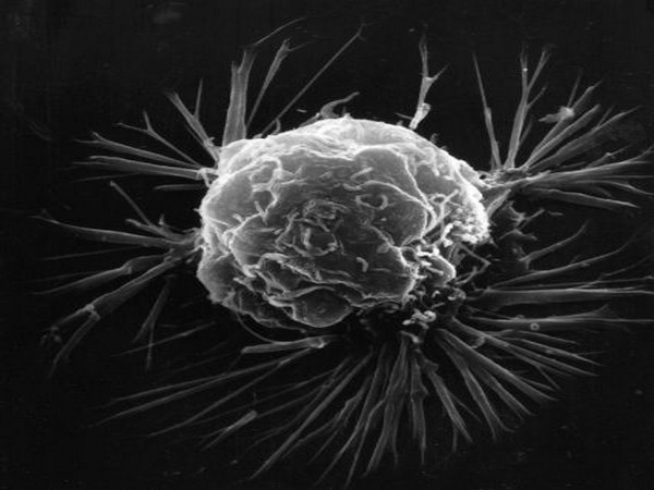 The device enables cancer drug testing in more realistic conditions