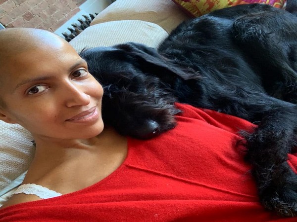 The 37-year-old succumbed to a rare form of cancer known as Epithelioid Sarcoma (Picture courtesy: Facebook)