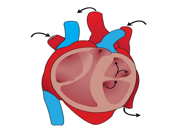 Menopausal age prior to age 50 had a dose-dependent effect on cardiovascular disease risk.