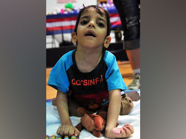 Representative image