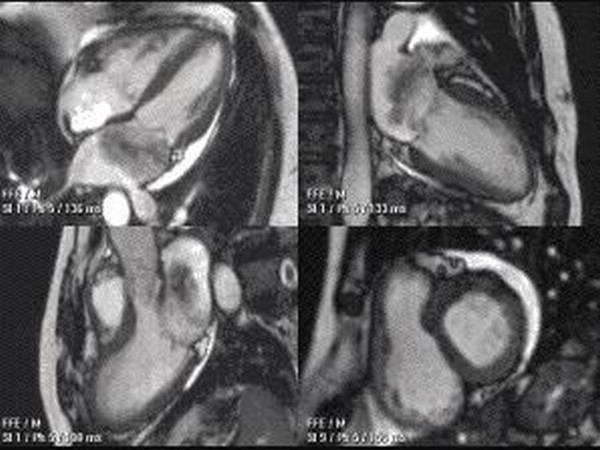 The AI technique was therefore shown for the first time to be able to predict which patients might die or suffer major adverse events, better than a doctor