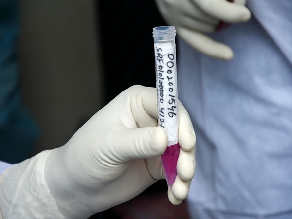 Representative image.