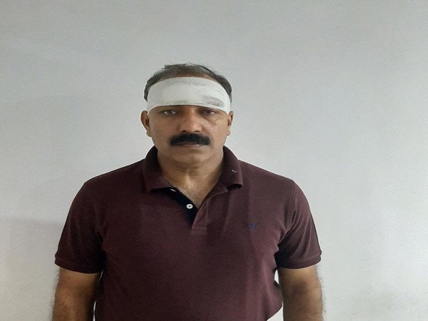 SHO Rajeev Bhardwaj received injuries in the Police-lawyers clash at Tis Hazari Court on Saturday. Photo/Delhi Police