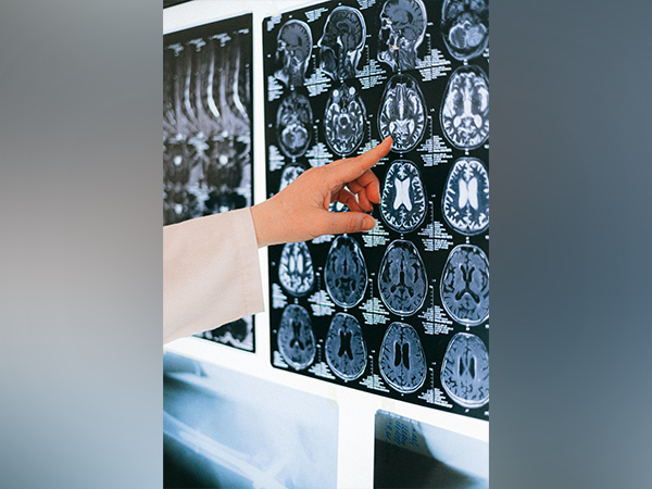 Reprresentative Image