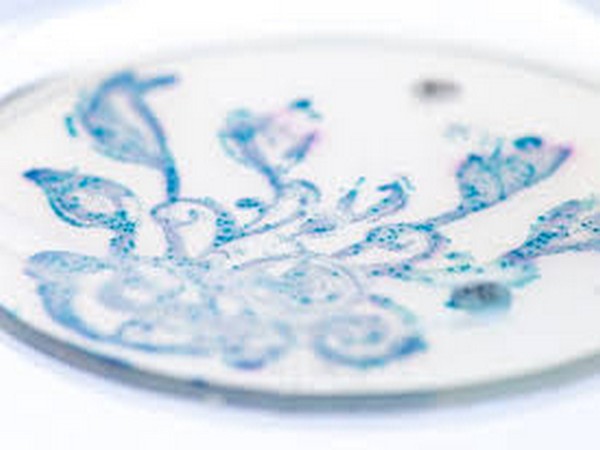 The depletion of the microbiome may be associated with the increased prevalence, in Western countries, of complex conditions like allergies, autoimmune and gastrointestinal diseases, obesity.