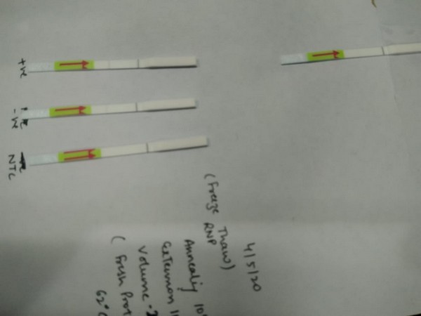CSIR-IGIB develop paper-based test for COVID-19