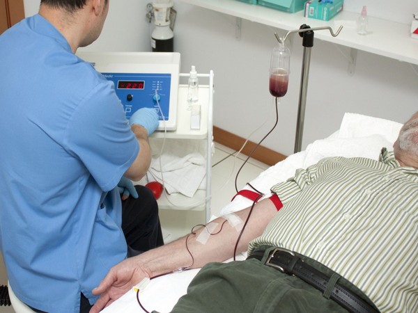 Representative image