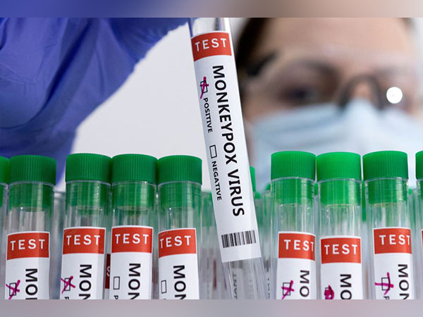 Representative image.