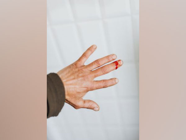 Representative image