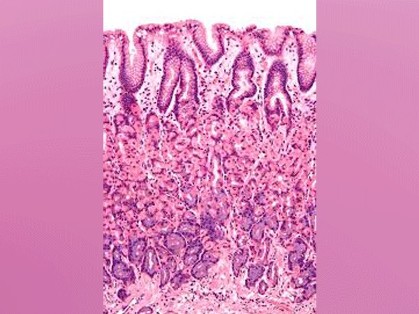 Microscopic view of gastrointestinal wall 