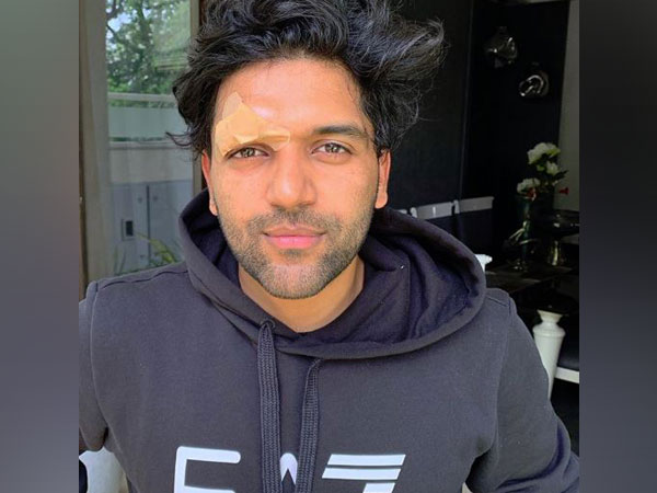 Singer Guru Randhawa shares a picture on his Instagram after being attacked in canada post live concert. (Photo courtesy: Guru Randhawa Instagram)