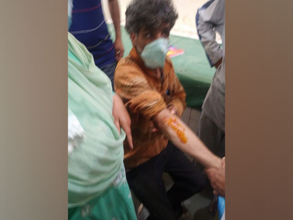 An injured civilian in the grenade attack (Photo/ANI)