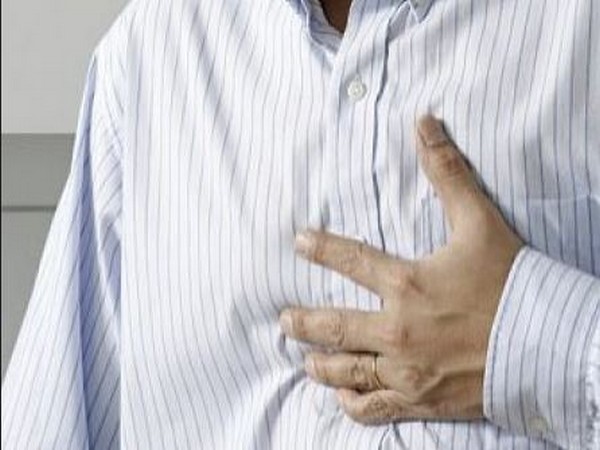 Representative Image