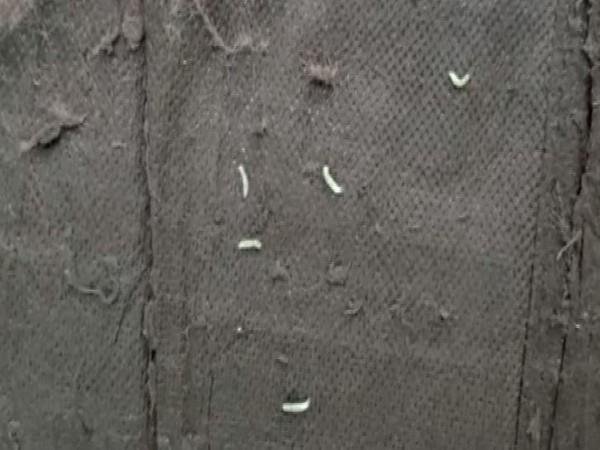 Worms found on beds in surgical ward of Mahoba district hospital [Photo/ANI]