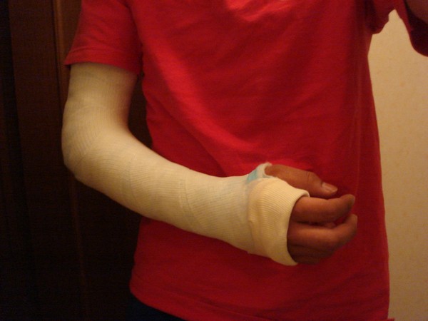 Representative image