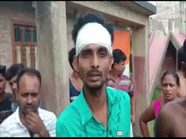 A person who got injured in the alleged altercation between BJP and TMC members. Photo/ANI