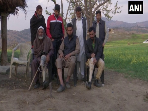 Residents of Jammu and Kashmir's Rajouri district who have suffered injuries due to ceasefire violations. (Photo/ANI)