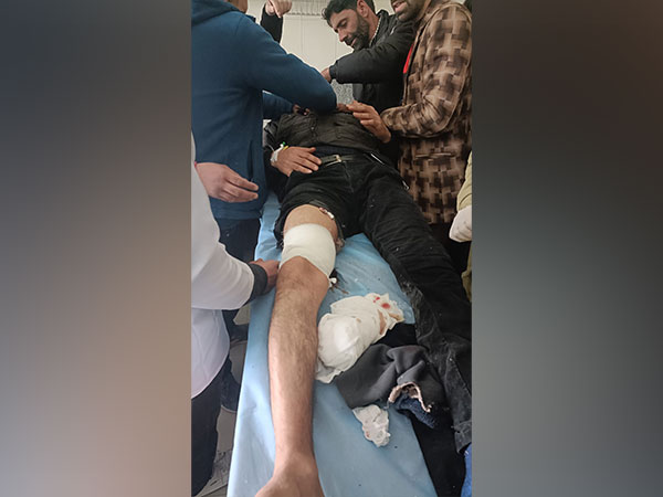 Bank employee who was shot at by terrorists in Pulwama on Thursday. (Photo/ANI)