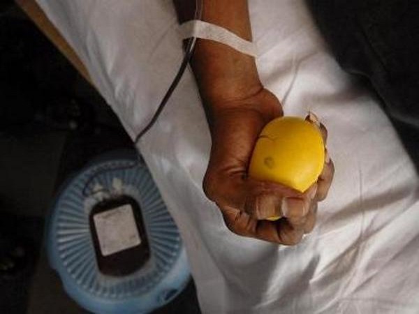 Representative image