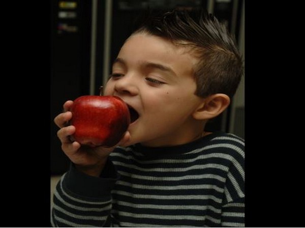 Representative image