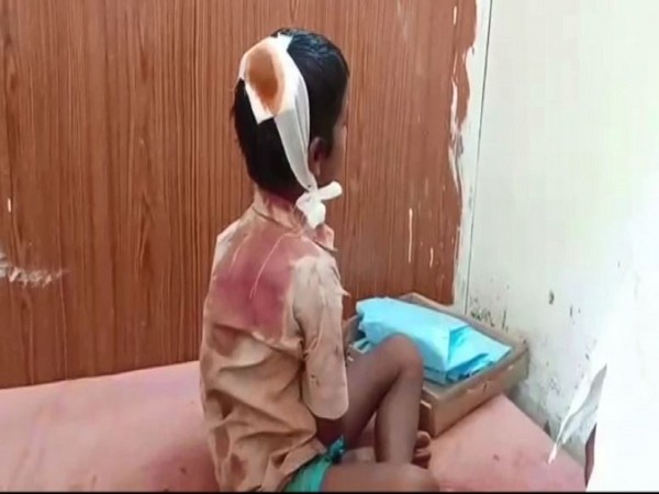 An injured student of the Mandal Parishad Urdu school in Gonegandla Mandal.