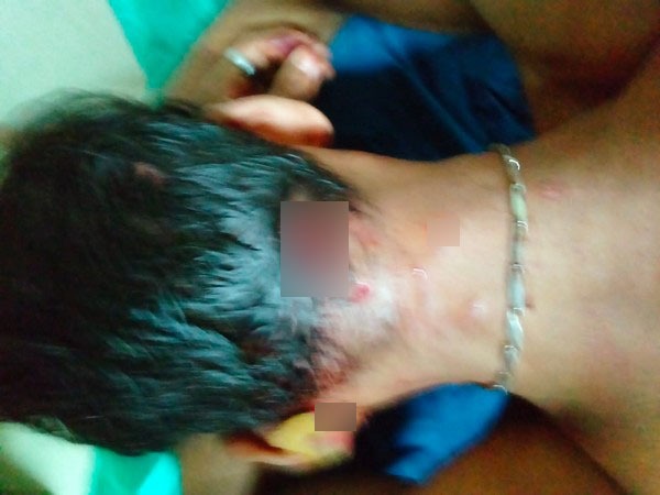 Injury marks on head of victim after leopard attack (photo/ANI)