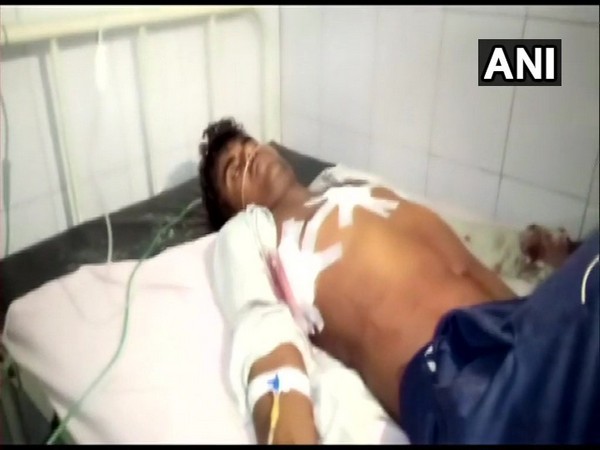 One of the men who sustained injuries in the cow smuggling incident undergoing treatment in Alwar hospital. (Photo/ANI)