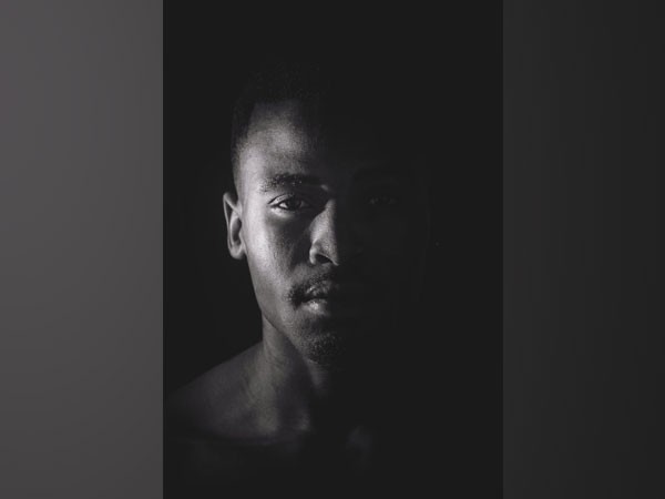 Representative image.