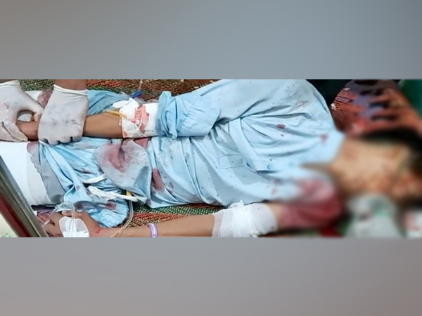 Teenager fell in ditch and died after being chased by police in PoK's Kotli.