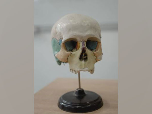 Representative image