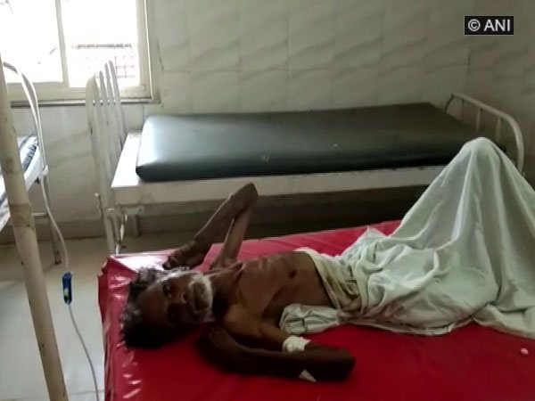 The man who was declared dead but found alive at govt hospital in Sagar District 